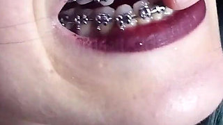 Biting My Fingers - Bite, Mouth, Teeth, Braces, Fetish Ita
