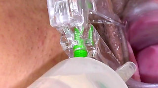 Hairy Pussy of Hot MILF Trinity Black Examined with Speculum