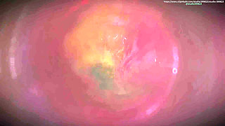 B032 a Man Is Shrunk by Two Beautiful Women and Used as a Dildo and Piston. Man Swallowed by Vagina