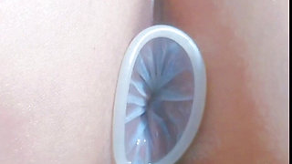 Assholegap Gaping Analstretch Analplay